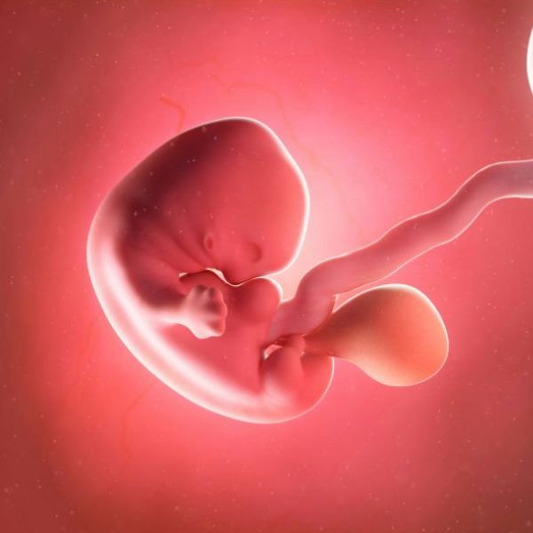 Foetal Alcohol Spectrum Disorders (FASD) Level 3